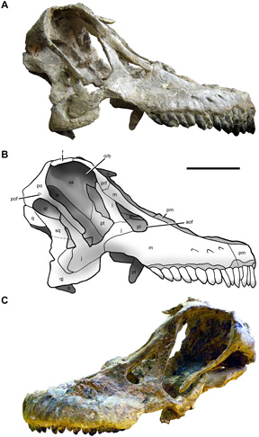 A view of the skull (lateral views)